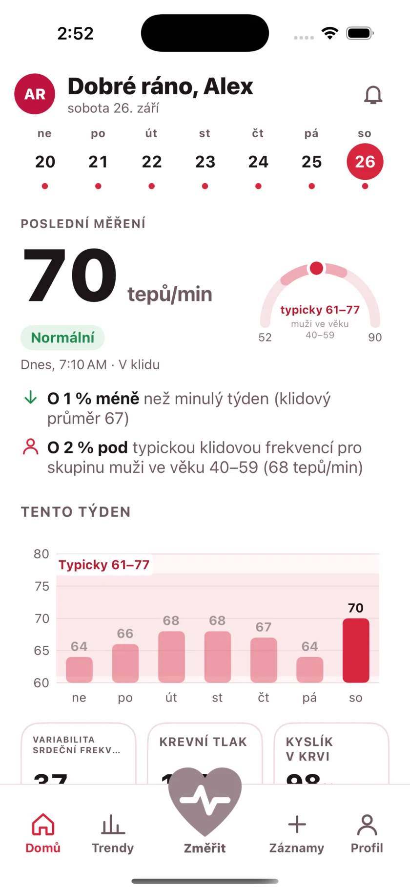The HeartGlance home screen: a week of days across the top, a resting reading of 66 bpm with a Normal pill, a gauge showing it against the typical range for men 40 to 59, and a bar chart of the week.