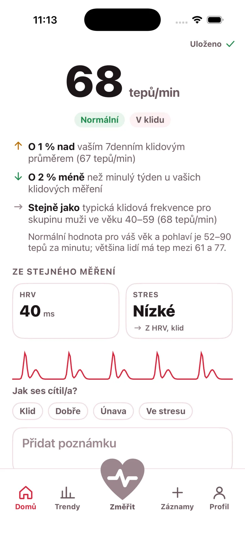 The result screen after a reading, showing the heart rate, its status, and the variability recorded from the same capture.