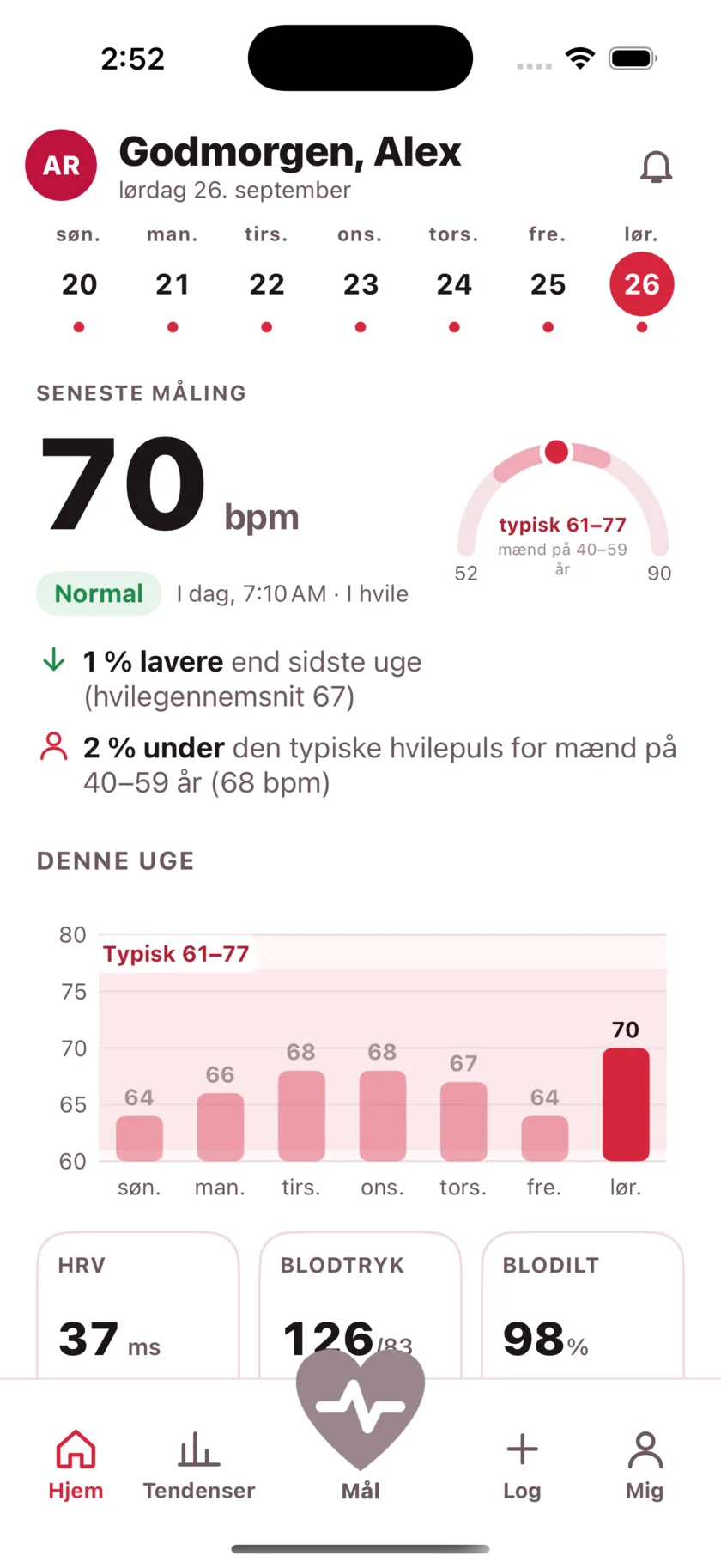 The HeartGlance home screen: a week of days across the top, a resting reading of 66 bpm with a Normal pill, a gauge showing it against the typical range for men 40 to 59, and a bar chart of the week.