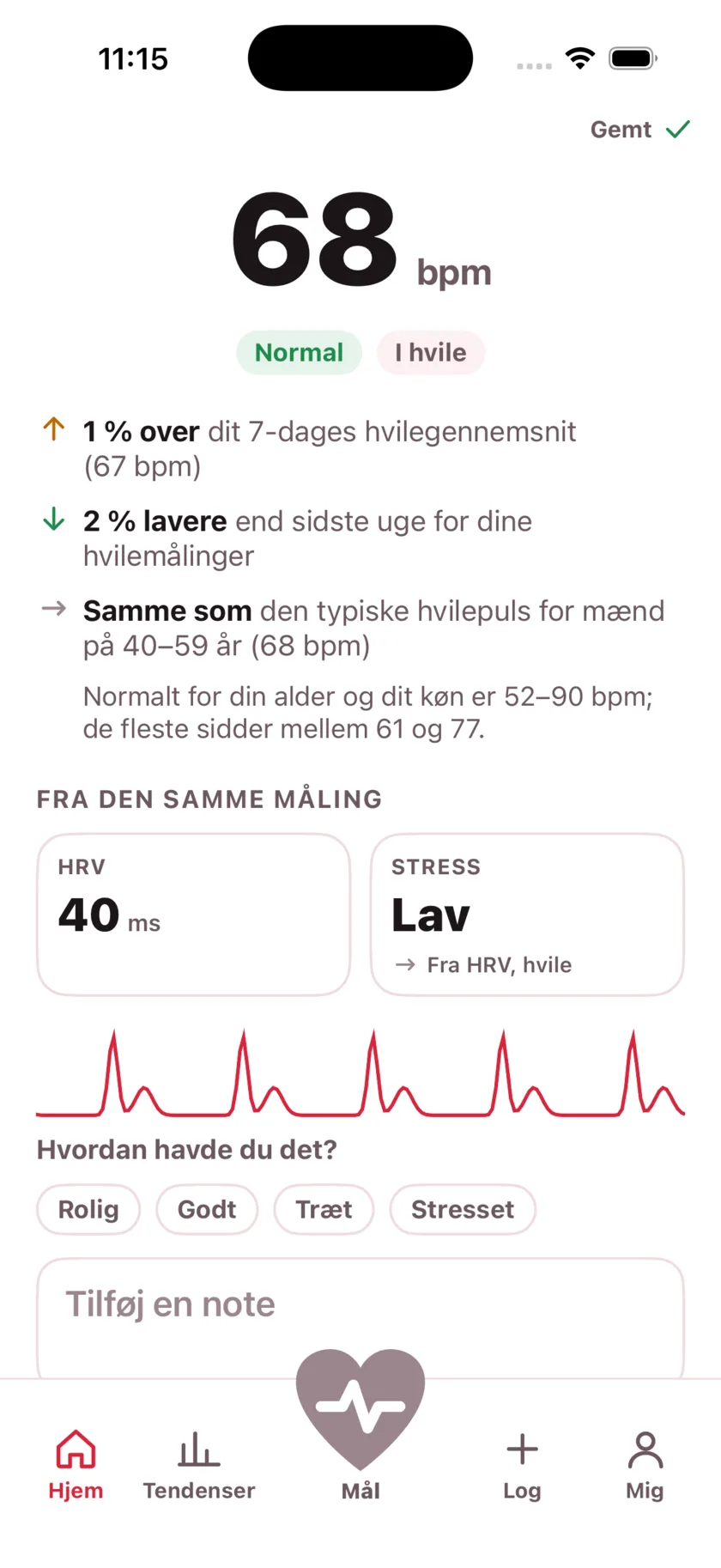The result screen after a reading, showing the heart rate, its status, and the variability recorded from the same capture.