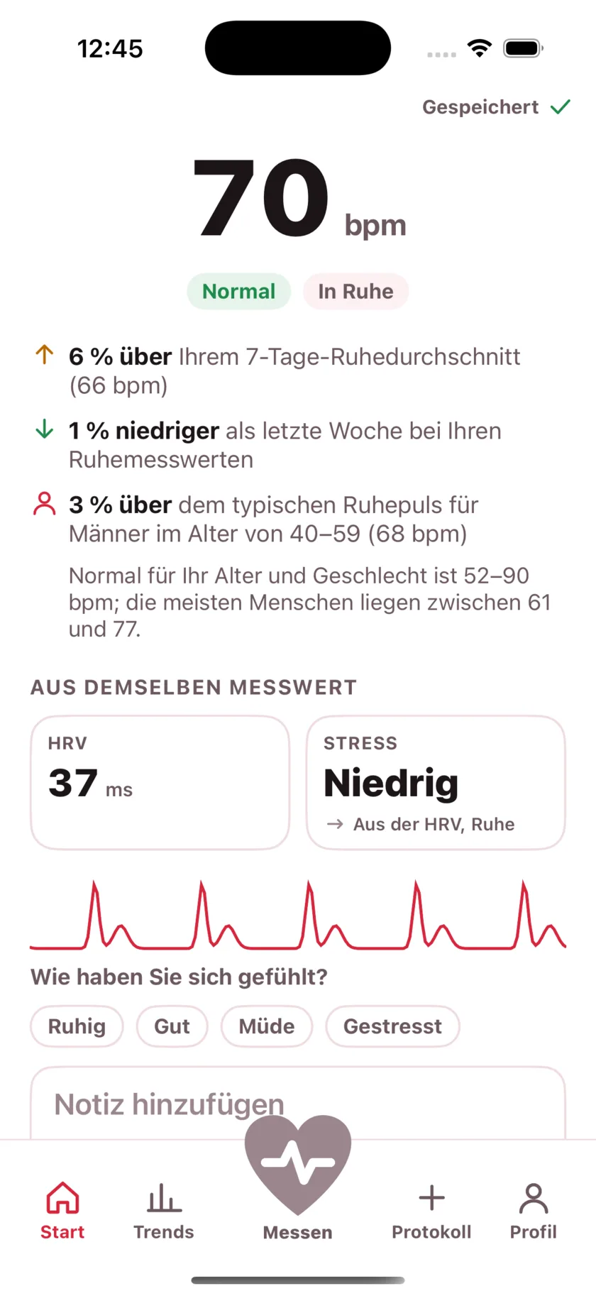 The result screen after a reading, showing the heart rate, its status, and the variability recorded from the same capture.
