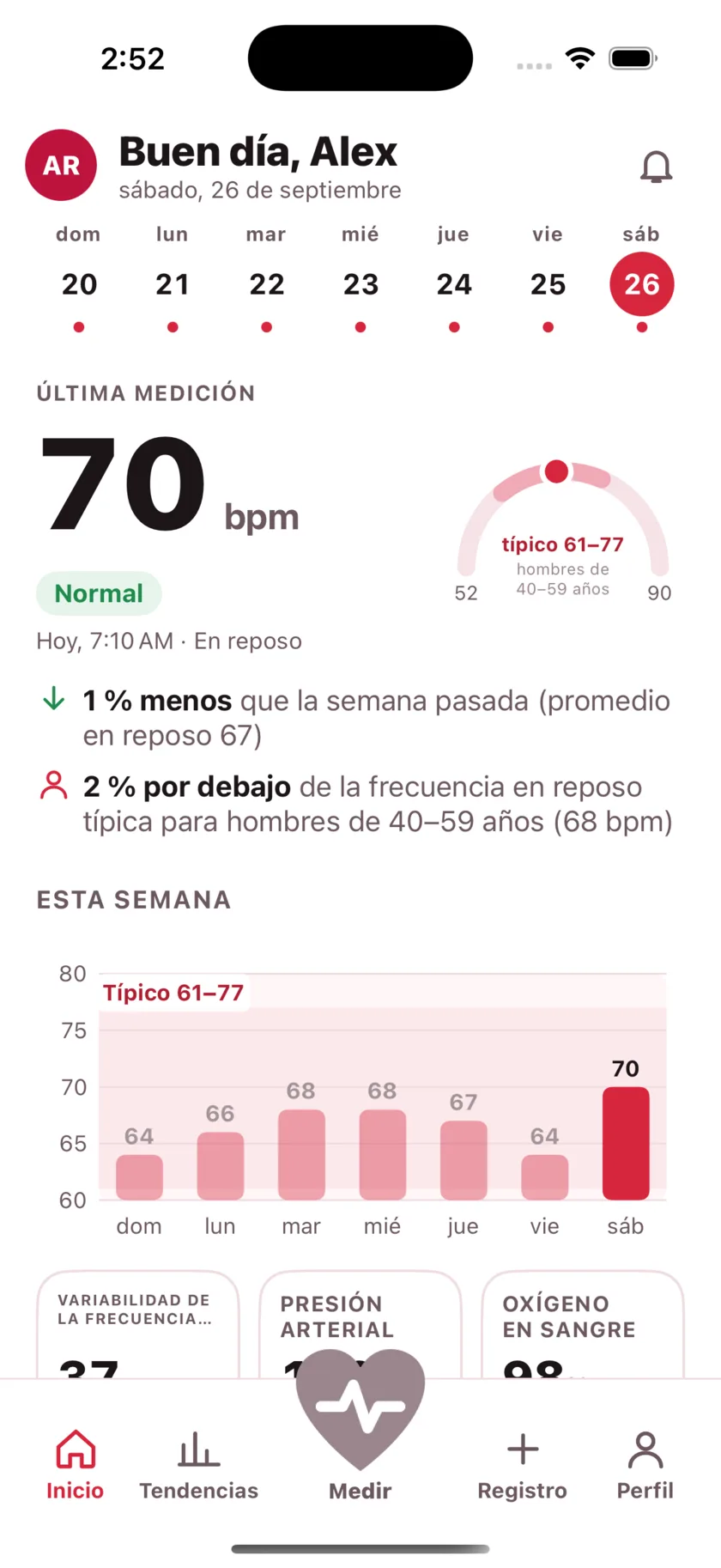 The HeartGlance home screen: a week of days across the top, a resting reading of 66 bpm with a Normal pill, a gauge showing it against the typical range for men 40 to 59, and a bar chart of the week.