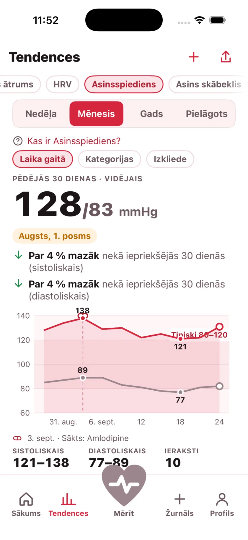 Thirty days of blood pressure as two lines, with a dashed marker on the day a medication started and the numbers falling after it.