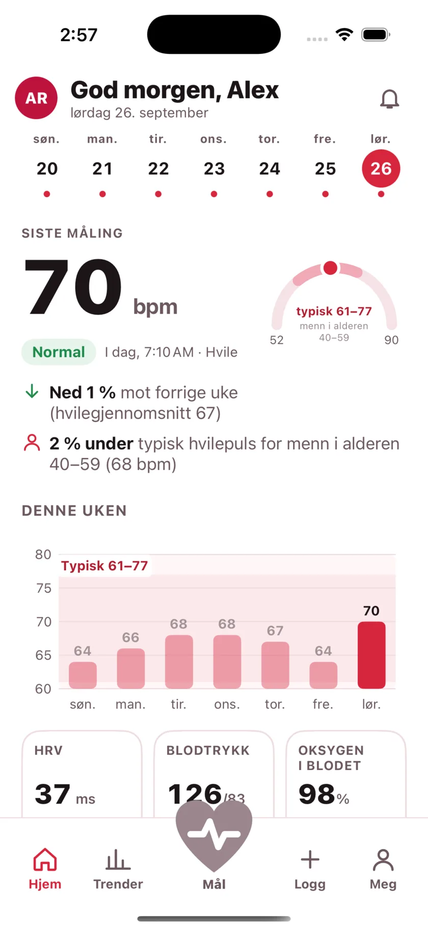 The HeartGlance home screen: a week of days across the top, a resting reading of 66 bpm with a Normal pill, a gauge showing it against the typical range for men 40 to 59, and a bar chart of the week.