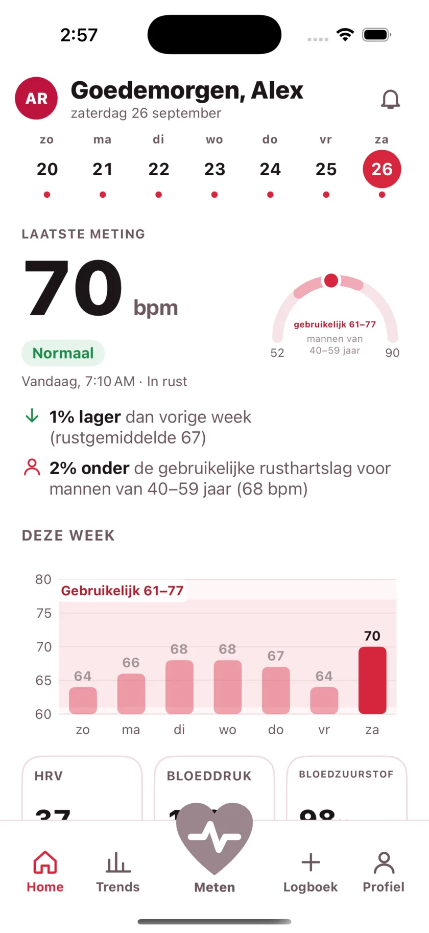 The HeartGlance home screen: a week of days across the top, a resting reading of 66 bpm with a Normal pill, a gauge showing it against the typical range for men 40 to 59, and a bar chart of the week.