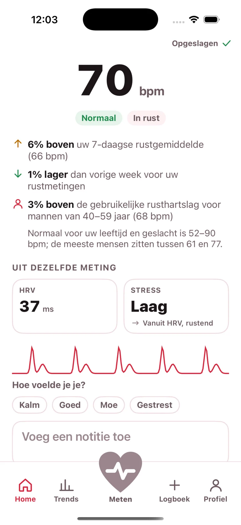 The result screen after a reading, showing the heart rate, its status, and the variability recorded from the same capture.