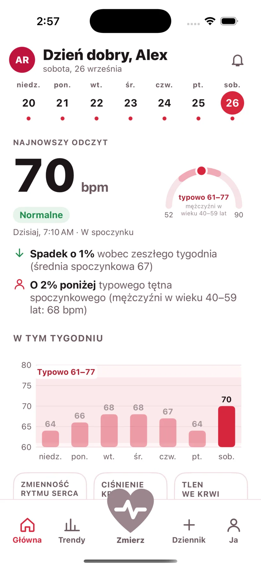 The HeartGlance home screen: a week of days across the top, a resting reading of 66 bpm with a Normal pill, a gauge showing it against the typical range for men 40 to 59, and a bar chart of the week.