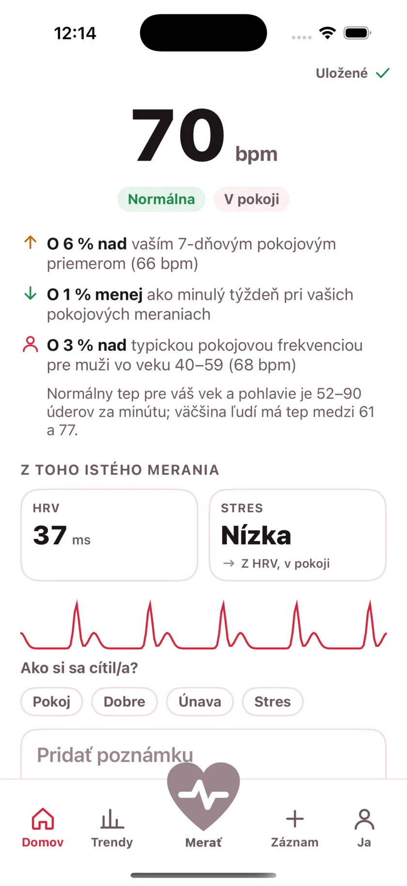 The result screen after a reading, showing the heart rate, its status, and the variability recorded from the same capture.