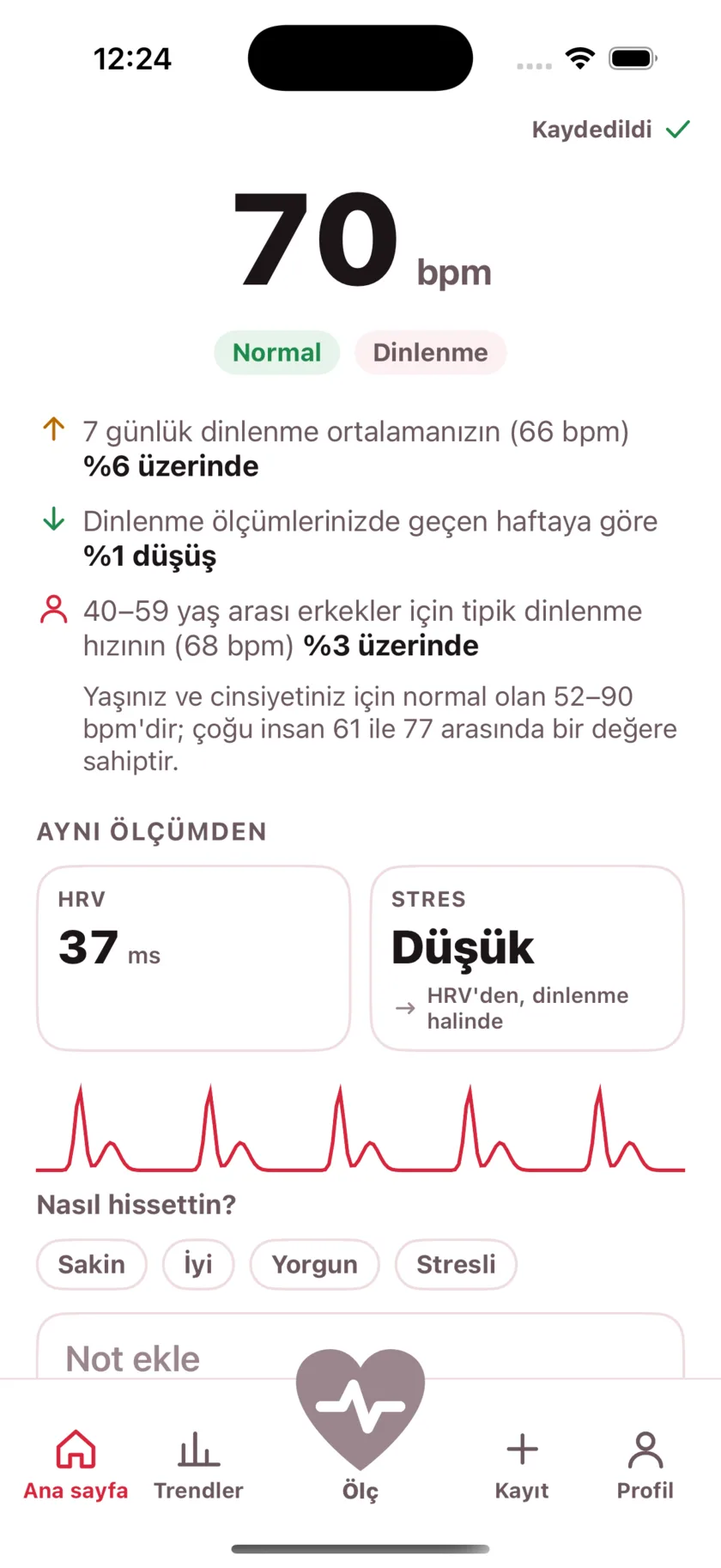 The result screen after a reading, showing the heart rate, its status, and the variability recorded from the same capture.